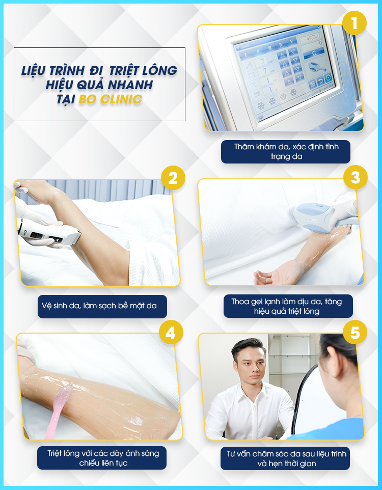 Liệu trình triệt lông hiệu quả nhanh chóng tại Bo Clinic đem lại làn da sạch đẹp