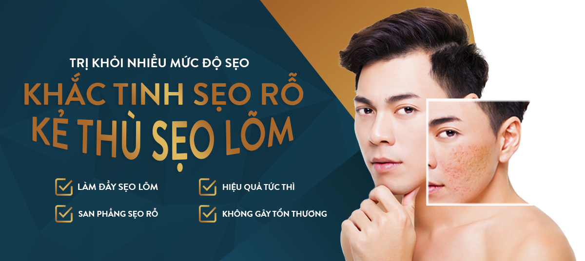 Đặc trị sẹo rỗ, sẹo lõm tại Bo Clinic