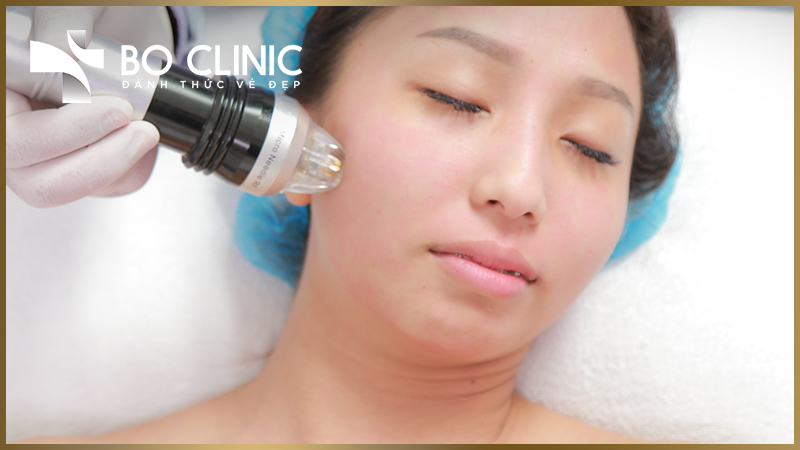 RF FRACTIONAL tế bào gốc