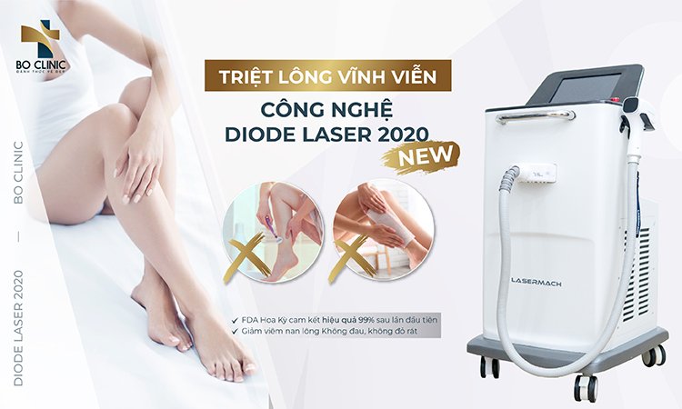 Triệt lông Diode Laser