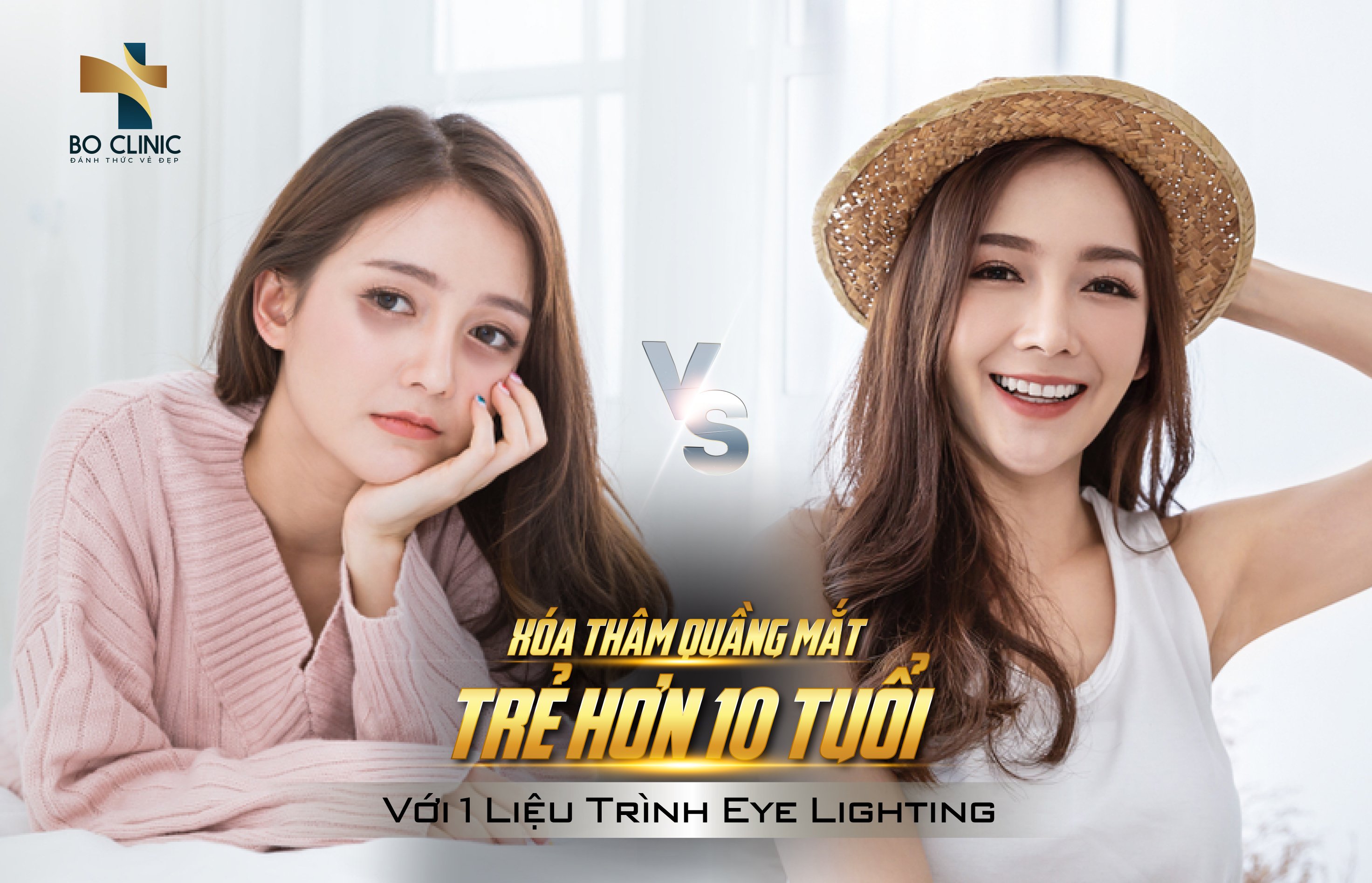 Trị thâm mắt Eye Lighting